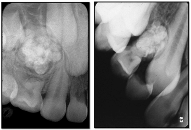 Radiografias1-1024x697-3